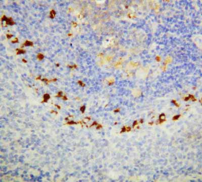 2 - Anti-SOCS1 Antibody ABO10557