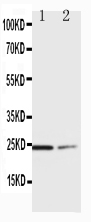 1 - Anti-SOCS1 Antibody ABO10557