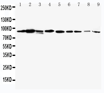 1 - Anti-STAT1 Antibody ABO10558