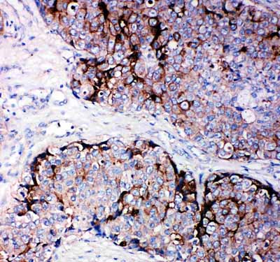 2 - Anti-TIMP-2 Antibody ABO10559