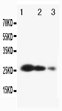 1 - Anti-TIMP-3 Antibody ABO10560