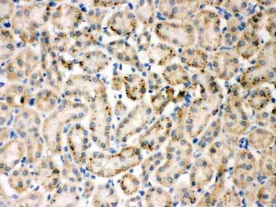 2 - Anti-TIMP-4 Antibody ABO10561