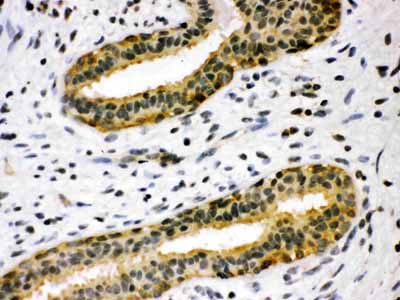 2 - Anti-TIMP-4 Antibody ABO10561