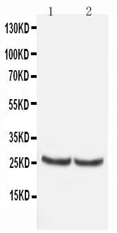 1 - Anti-TIMP-4 Antibody ABO10561
