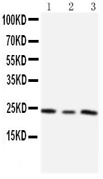 1 - Anti-TIMP-4 Antibody ABO10562