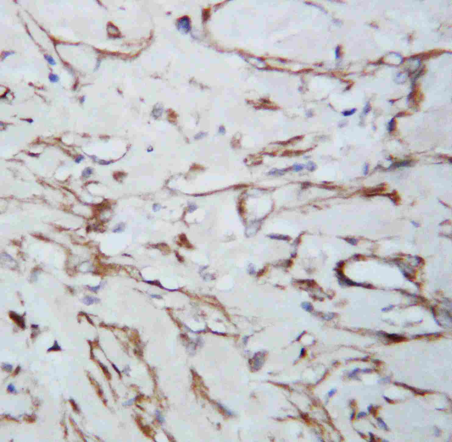 2 - Anti-VEGF Antibody ABO10563
