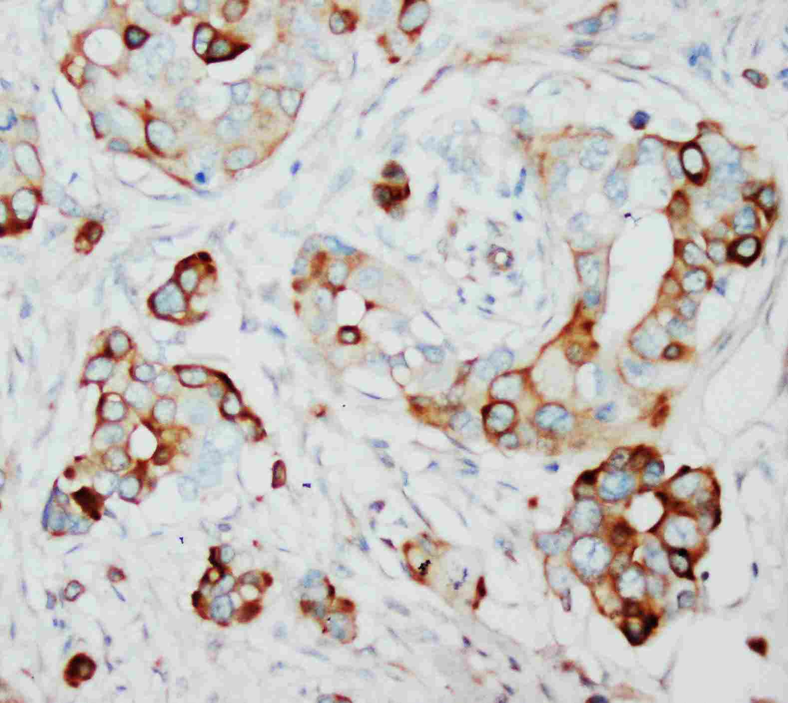 2 - Anti-SKP2 Antibody ABO10565