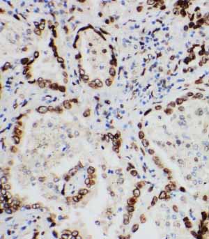 2 - Anti-Lamin A/C Antibody ABO10566