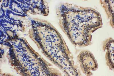 2 - Anti-Lamin A/C Antibody ABO10566