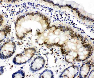 2 - Anti-Lamin A/C Antibody ABO10566