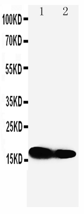 1 - Anti-IFITM1 Antibody ABO10570