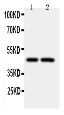 1 - Anti-Caspase-2 Antibody ABO10571