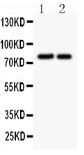 1 - Anti-Gamma Catenin Antibody ABO10574
