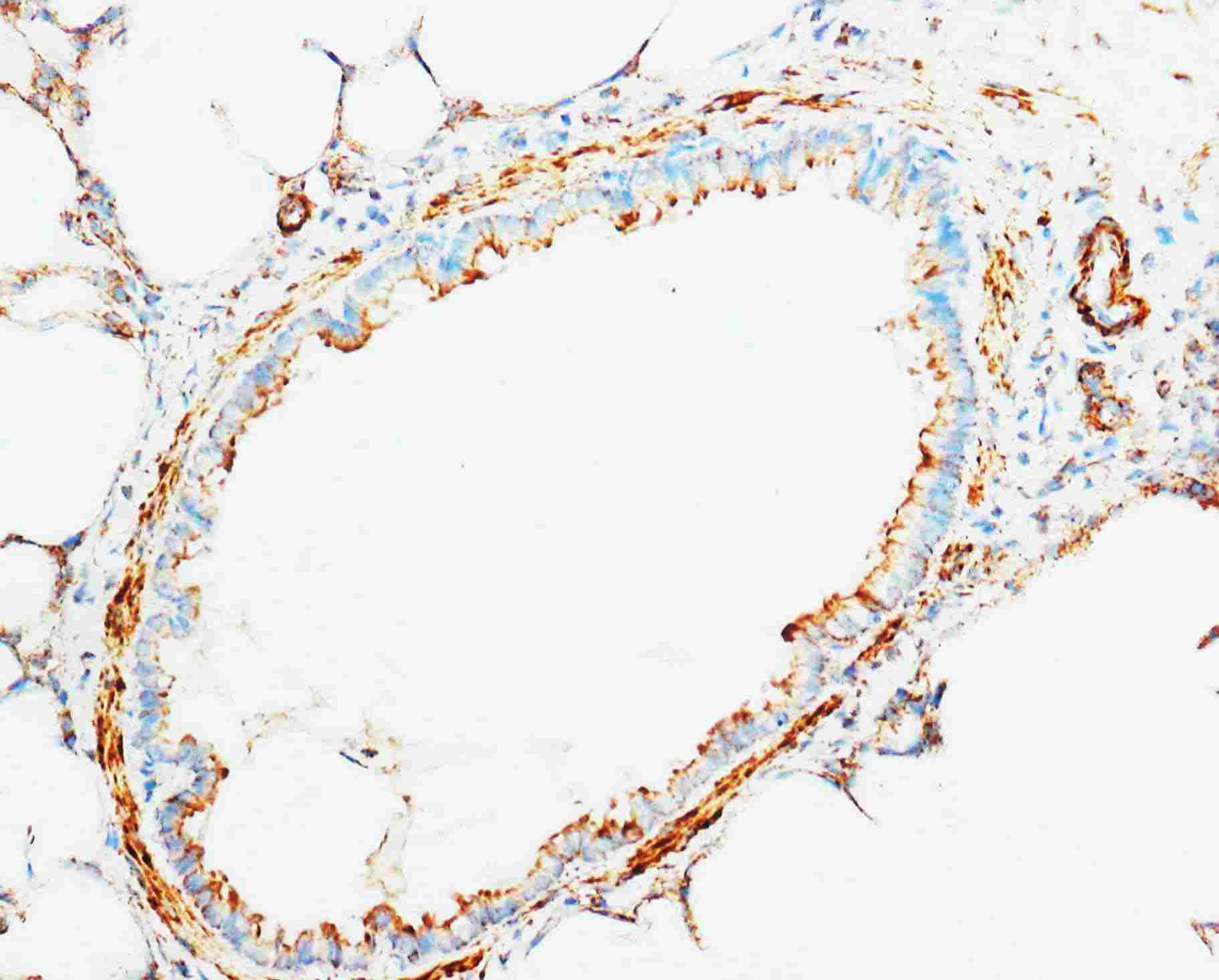 2 - Anti-Cytochrome C Antibody ABO10575