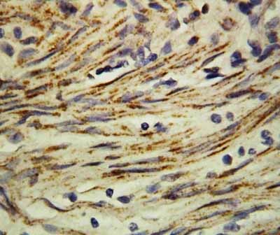 2 - Anti-MMP16 Antibody ABO10578