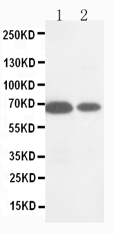 1 - Anti-MMP16 Antibody ABO10578