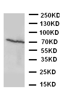 1 - Anti-Estrogen Receptor Beta Antibody ABO10581