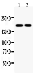 1 - Anti-Topoisomerase II Alpha Antibody ABO10582