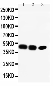 1 - Anti-CCR6 Antibody ABO10586