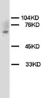 1 - Anti-Chk2 Antibody ABO10587
