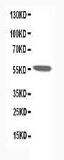 1 - Anti-Nicotinic Acetylcholine Receptor Alpha 1 Antibody ABO10588