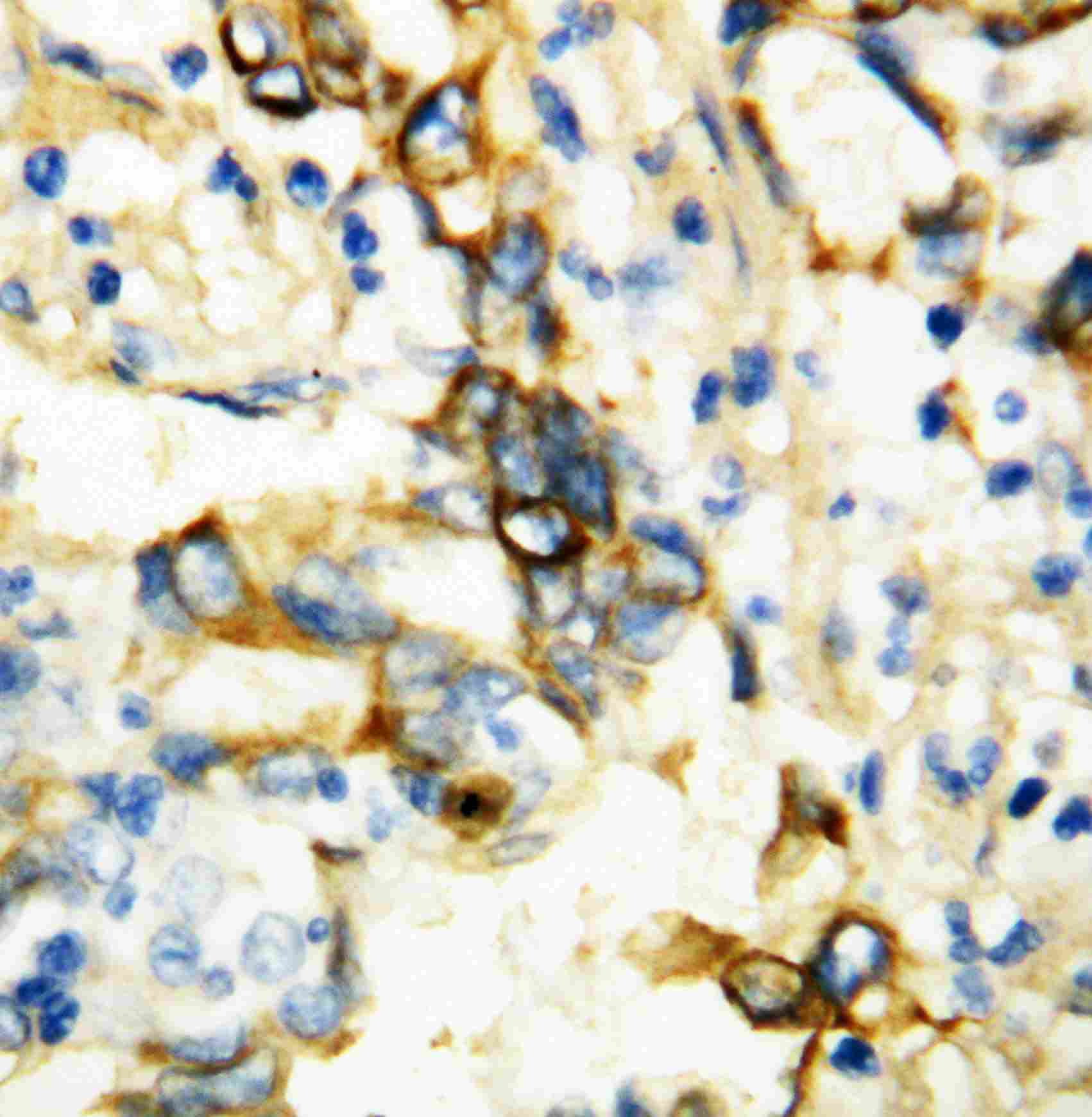 2 - Anti-TNFsR I Antibody ABO10591