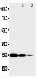 1 - Anti-TNFsR I Antibody ABO10591