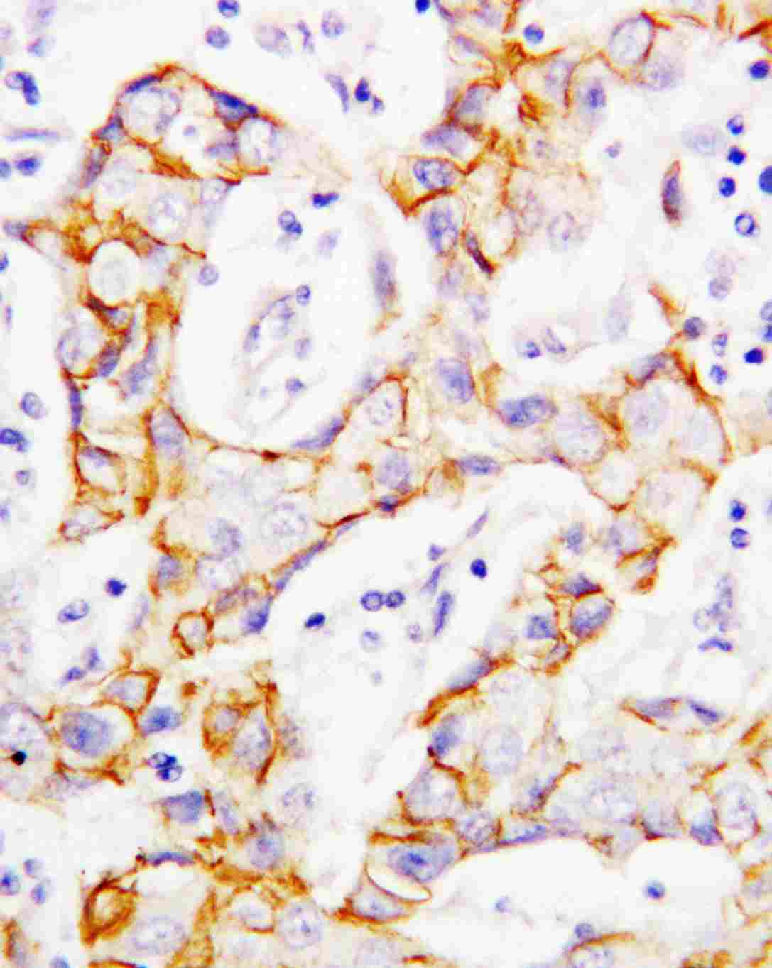 2 - Anti-Beta Catenin Antibody ABO10593