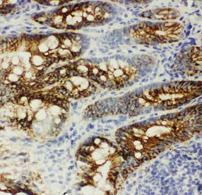 2 - Anti-Beta Catenin Antibody ABO10593