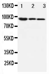 1 - Anti-Beta Catenin Antibody ABO10593