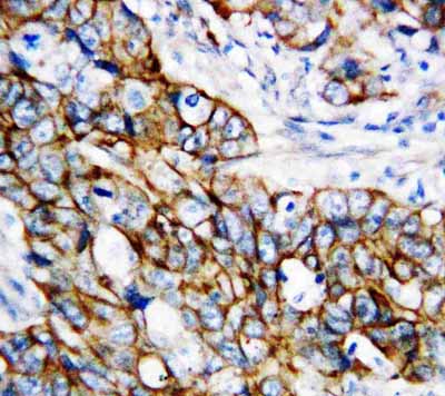 2 - Anti-Beta Catenin Antibody ABO10594