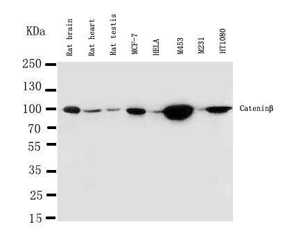1 - Anti-Beta Catenin Antibody ABO10594