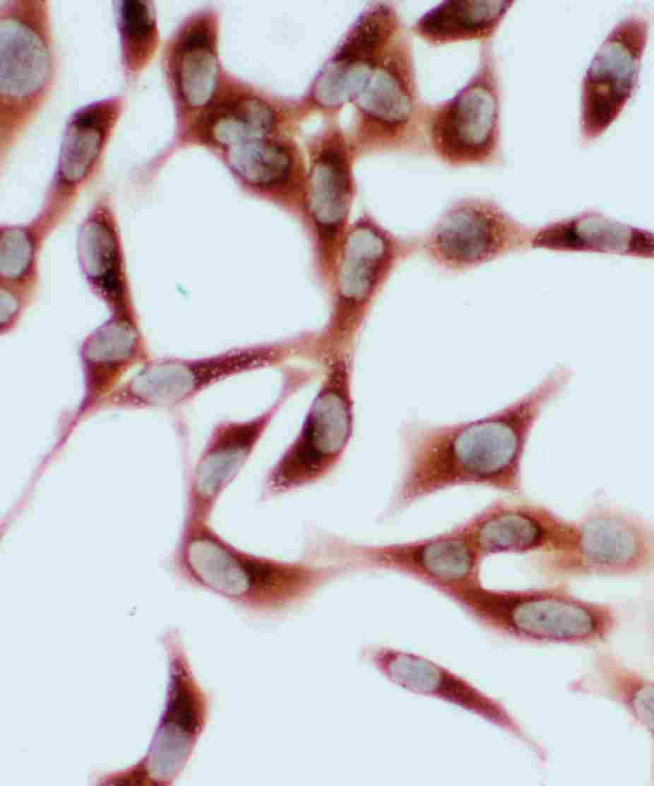 8 - Anti-Hsc70 Antibody ABO10595