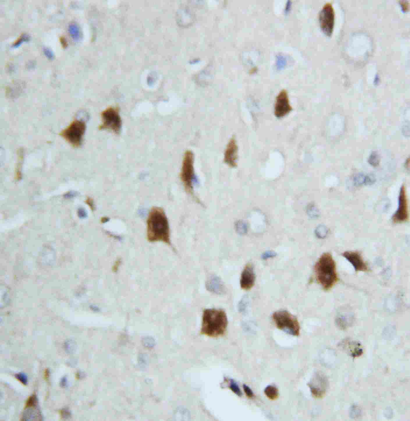 2 - Anti-Hsc70 Antibody ABO10595