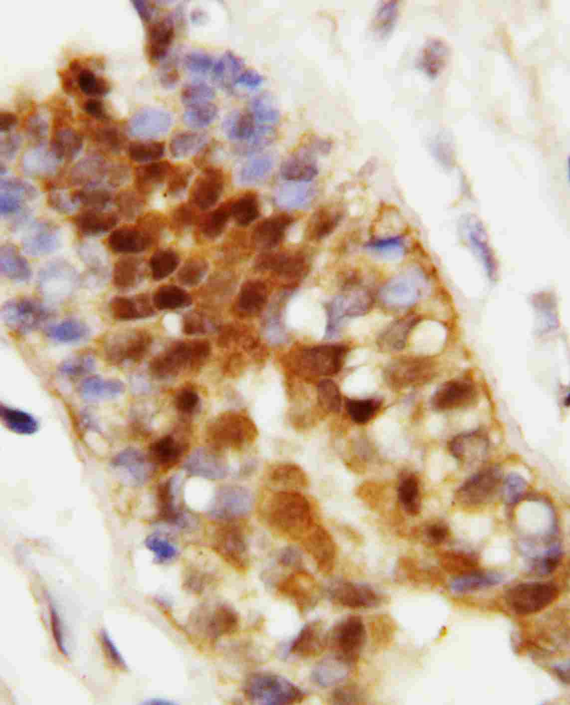 2 - Anti-Hsc70 Antibody ABO10595