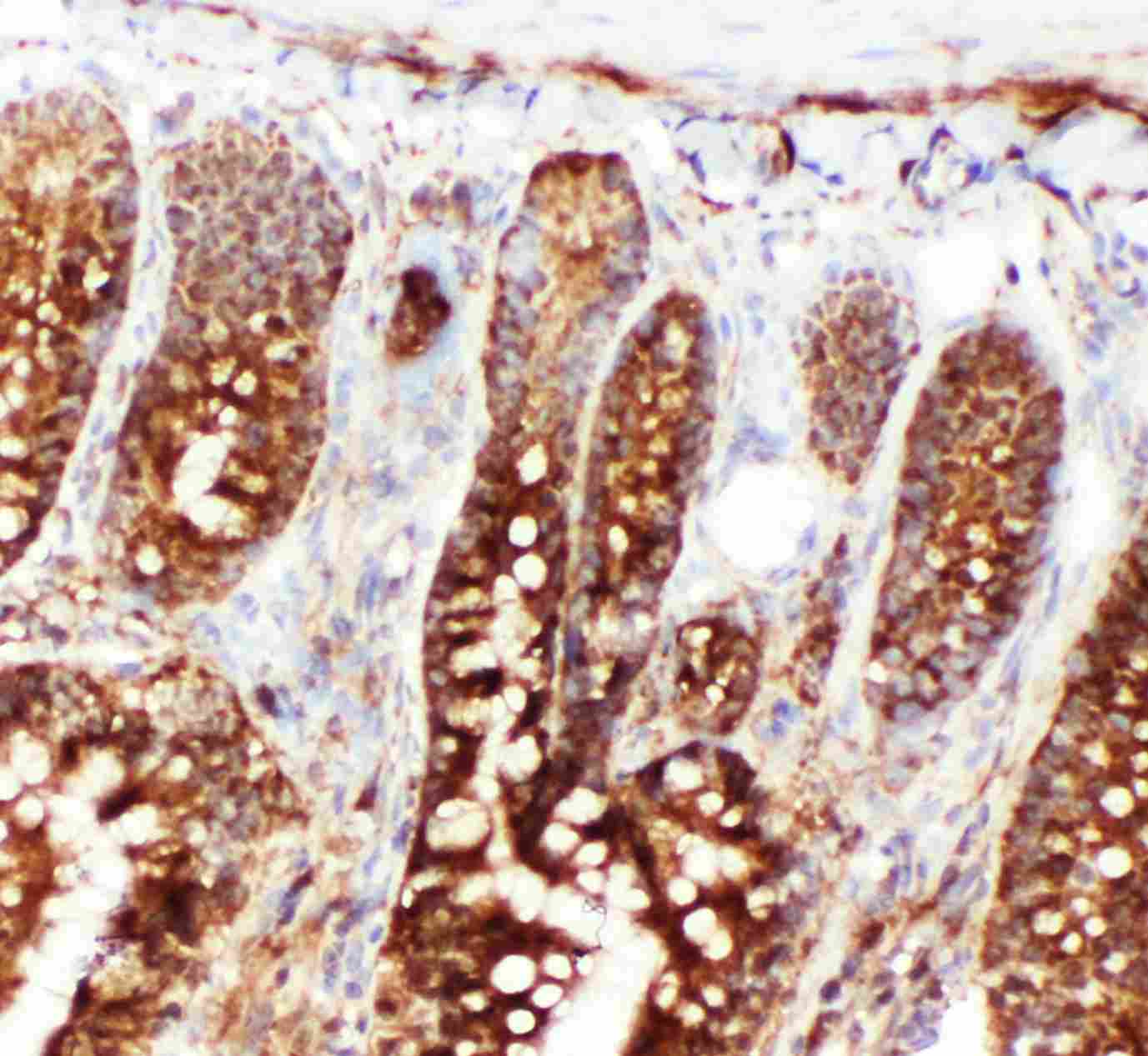 2 - Anti-Hsc70 Antibody ABO10595