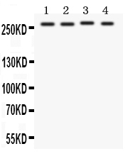 1 - Anti-Notch1 Antibody ABO10596