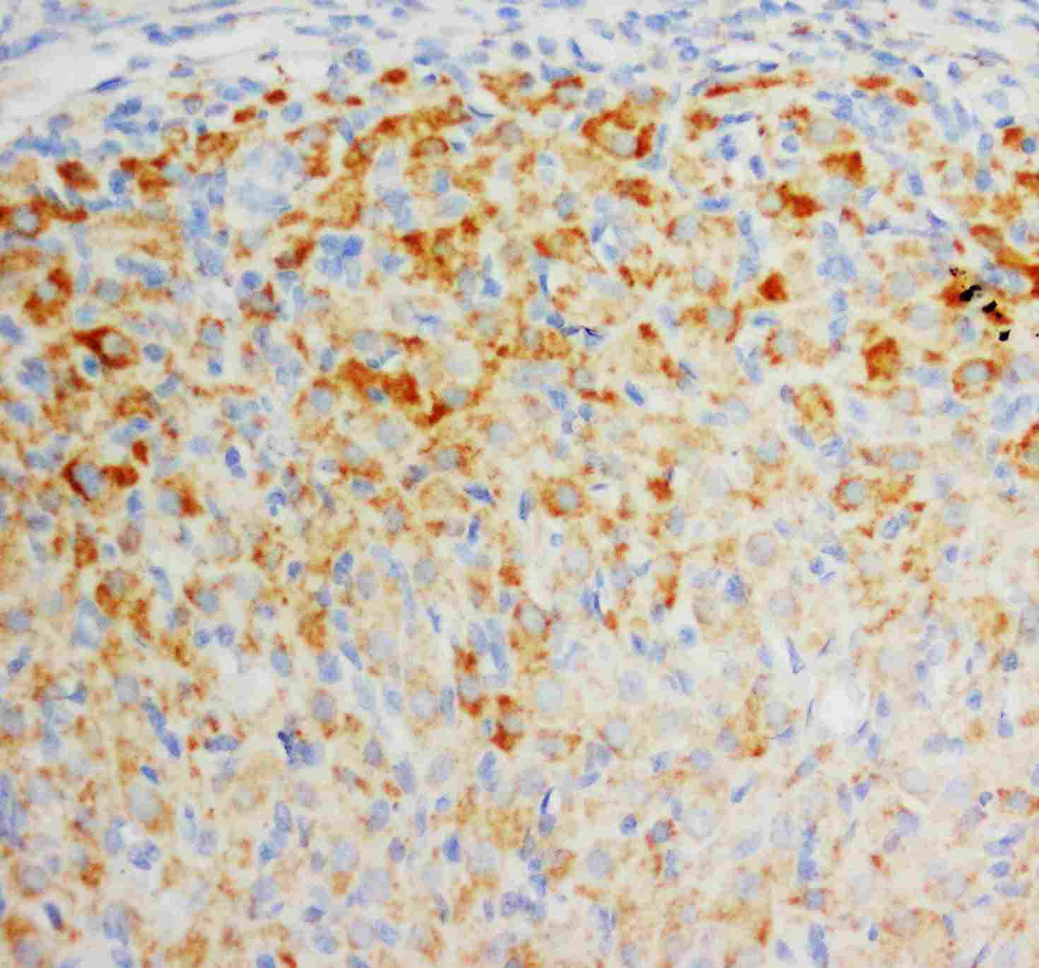 2 - Anti-FGF8 Antibody ABO10597