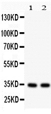 1 - Anti-XAF1 Antibody ABO10598