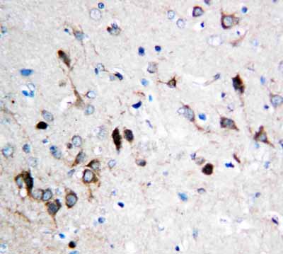2 - Anti-NMDAR1 Antibody ABO10600