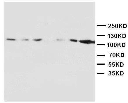 1 - Anti-NMDAR1 Antibody ABO10600
