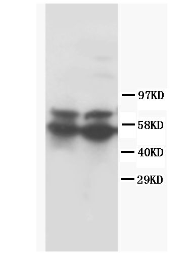 1 - Anti-RUNX2 Antibody ABO10602