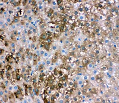 2 - Anti-liver FABP Antibody ABO10606