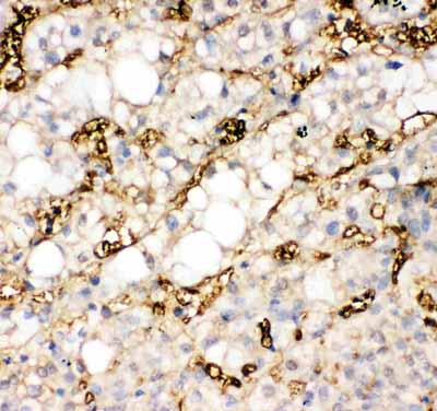 2 - Anti-liver FABP Antibody ABO10606