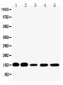 1 - Anti-liver FABP Antibody ABO10606
