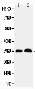 1 - Anti-Aquaporin 5 Antibody ABO10607
