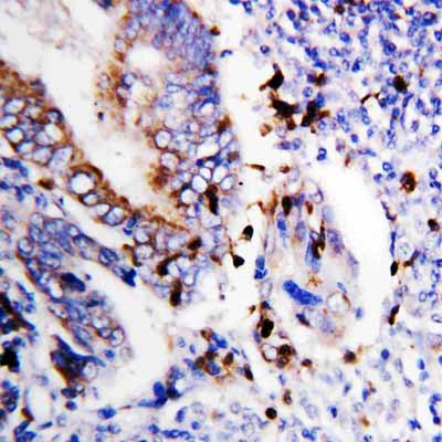 2 - Anti-Bcl-XS Antibody ABO10609