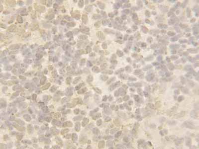 2 - Anti-Cullin 4B Antibody ABO10610
