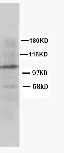 1 - Anti-Cullin 4B Antibody ABO10610