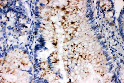 2 - Anti-SSX2 Antibody ABO10612